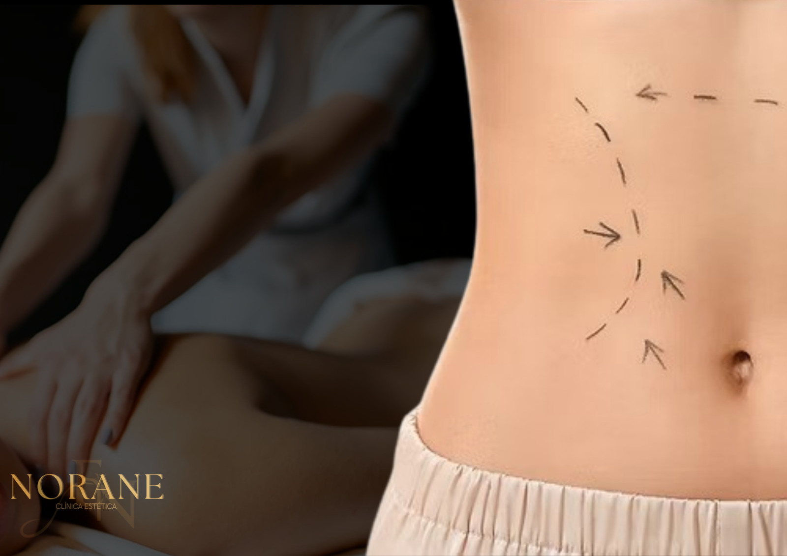 Hidrolipoclasia + Massagem Modeladora