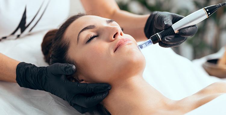 Microagulhamento - Pele De Porcelana.